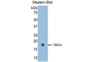 Western blot analysis of the recombinant protein. (LGALS9C 抗体  (AA 17-148))