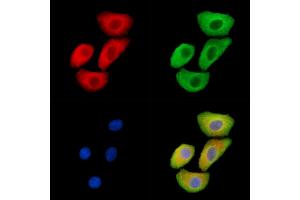 ABIN6265590 and ABIN6279872 staining Hela cells by IF/ICC. (TJP3 抗体  (C-Term))
