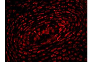 Formalin-fixed and paraffin-embedded mouse embryo labeled with Anti-HOXA10 Polyclonal Antibody, Unconjugated (ABIN723725) 1:200, overnight at 4 °C, The secondary antibody was Goat Anti-Rabbit IgG,Cy3 conjugated used at 1:200 dilution for 40 minutes at 37 °C. (HOXA10 抗体  (AA 311-410))