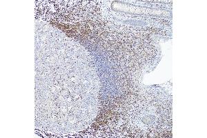 Immunohistochemistry (IHC) image for anti-B-Cell CLL/lymphoma 2 (BCL2) antibody (ABIN7265810)