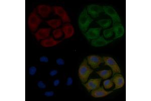 FAM71D Mouse Monoclonal Antibody staining Hela cells by IF/ICC. (FAM71D 抗体)