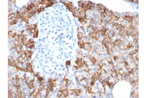 Immunohistochemistry (IHC) image for anti-Tumor-Associated Calcium Signal Transducer 2 (TACSTD2) (AA 31-274) antibody (ABIN6939972)