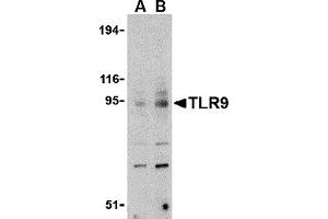 Western Blotting (WB) image for anti-Toll-Like Receptor 9 (TLR9) (C-Term) antibody (ABIN1030747) (TLR9 抗体  (C-Term))