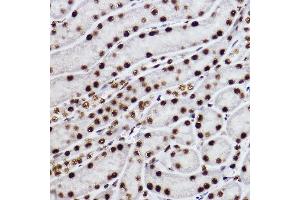 Immunohistochemistry of paraffin-embedded mouse kidney using CTBP2 Rabbit mAb (ABIN7265979) at dilution of 1:100 (40x lens).