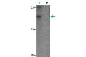 Western blot analysis of YPEL3 in A-20 cell lysate with YPEL3 polyclonal antibody  at 1 ug/mL in (lane 1) the absence and (lane 2) the presence of blocking peptide. (YPEL3 抗体  (N-Term))
