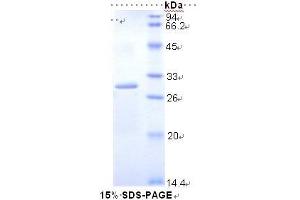 SDS-PAGE (SDS) image for Dihydrolipoyl Transacetylase (DLAT) (AA 368-626) protein (His tag) (ABIN1878393)