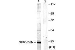 Western blot analysis of extracts from mouse lung cells, using Survivin (Ab-117) Antibody. (Survivin 抗体  (AA 86-135))