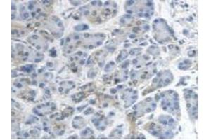 Detection of MTUS1 in Human Pancreas Tissue using Polyclonal Antibody to Mitochondrial Tumor Suppressor 1 (MTUS1) (MTUS1 抗体  (AA 1018-1270))