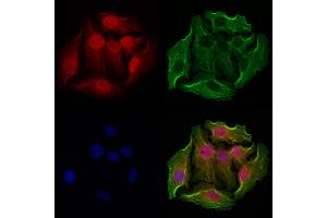 ABIN6263746 and ABIN6272947 staining Hela cells by IF/ICC. (NSUN2 抗体  (Internal Region))