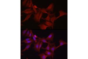 Immunofluorescence analysis of U2OS cells using GPX4 Rabbit pAb (ABIN3015729, ABIN3015730, ABIN3015731, ABIN1680090 and ABIN6219078) at dilution of 1:200 (40x lens). (GPX4 抗体  (AA 30-197))