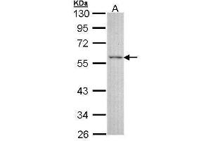 WB Image Sample (30 ug of whole cell lysate) A: A431 , 10% SDS PAGE antibody diluted at 1:3000 (ESRRG 抗体)