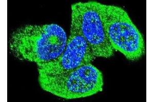 Immunofluorescence (IF) image for anti-HRas proto-oncogene, GTPase (HRAS) antibody (ABIN2996311) (HRAS 抗体)