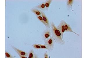 Immunocytochemistry analysis of Hela cells using ABIN7139620 at dilution of 1:100 (HIST1H1E 抗体  (pSer35))