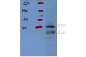 Western Blotting (WB) image for anti-NADH Dehydrogenase (Ubiquinone) Fe-S Protein 1, 75kDa (NADH-Coenzyme Q Reductase) (NDUFS1) (Middle Region) antibody (ABIN2786794)
