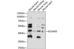 Western blot analysis of extracts of various cell lines, using KCN antibody (ABIN7269482) at 1:1000 dilution.