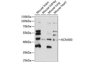 Western blot analysis of extracts of various cell lines, using KCN antibody (ABIN7269482) at 1:1000 dilution. (KCNAB3 抗体  (AA 285-404))