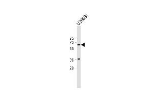 Anti-TXK Antibody (N-term) at 1:2000 dilution + U266B1 whole cell lysate Lysates/proteins at 20 μg per lane. (TXK 抗体  (N-Term))