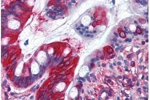 Human Small Intestine (formalin-fixed, paraffin-embedded) stained with TFG antibody ABIN290224 at 10 ug/ml followed by biotinylated goat anti-rabbit IgG secondary antibody ABIN481713, alkaline phosphatase-streptavidin and chromogen. (TFG 抗体  (AA 350-400))