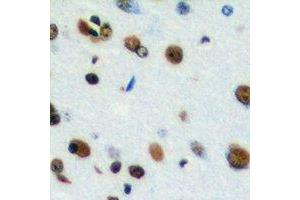Immunohistochemical analysis of CstF-64T staining in human brain formalin fixed paraffin embedded tissue section.