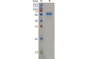 SDS-PAGE (SDS) image for Placenta Growth Factor (PGF) (AA 19-170) protein (Fc Tag) (ABIN7092739)