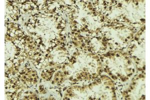 ABIN6272855 at 1/100 staining Human lung tissue by IHC-P. (CNOT1 抗体  (Internal Region))
