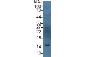 Western Blot; Sample: Human Serum; Primary Ab: 3µg/ml Rabbit Anti-Human ANG Antibody Second Ab: 0. (ANG 抗体  (AA 25-147))