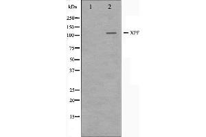 Western Blotting (WB) image for anti-Excision Repair Cross-Complementing Rodent Repair Deficiency, Complementation Group 4 (ERCC4) (C-Term) antibody (ABIN6266064)