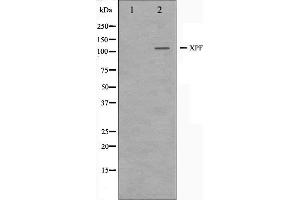 Western blot analysis on 293 cell lysate using XPF Antibody. (ERCC4 抗体  (C-Term))