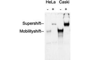Anti-AP2 alpha/beta Antibody was used in an Electrophoretic Mobility Shift Assay (EMSA) to supershift the protein-DNA complex. (AP2 alpha/beta (C-Term) 抗体)