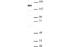 Western Blot: Nuclear extract of Saos-2 cells (20 µg per lane) probed with the SIP1 antibody (mAb) at a dilution of 1 µg/ml. (SIP1 抗体  (AA 1-360))