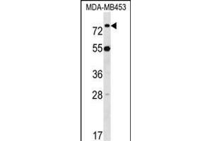 LDB3 Antibody (Center) (ABIN1538145 and ABIN2848672) western blot analysis in MDA-M cell line lysates (35 μg/lane). (LIM Domain Binding 3 Protein 抗体  (AA 235-262))