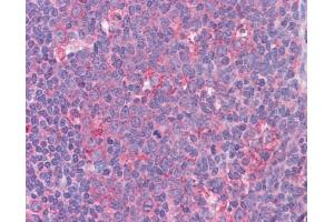 Immunohistochemistry (IHC) image for anti-Signal Transducer and Activator of Transcription 6, Interleukin-4 Induced (STAT6) (C-Term) antibody (ABIN2777200)