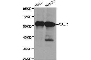 Western Blotting (WB) image for anti-Calreticulin (CALR) antibody (ABIN3021344) (Calreticulin 抗体)