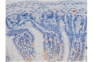 ABIN6267458 at 1/200 staining Mouse intestinal tissue sections by IHC-P.