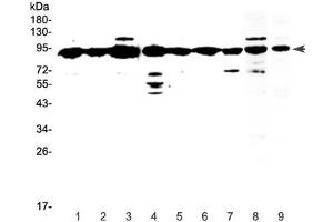 Western blot testing of human 1) HeLa, 2) placenta, 3) MCF7, 4) HepG2, 5) A549, 6) SKOV3, 7) PANC-1 and 8) mouse testis and 9) rat testis lysate with XRCC1 antibody at 0. (XRCC1 抗体)