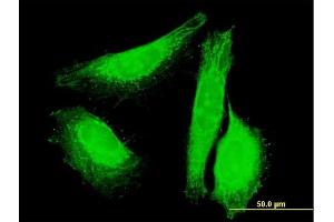 Immunofluorescence of purified MaxPab antibody to UNC84A on HeLa cell.