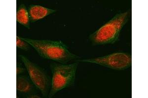 IF analysis of RAB3GAP1 using anti-RAB3GAP1 antibody (ABIN7599702) and Anti-Beta Tubulin Antibody (ABIN7602743).