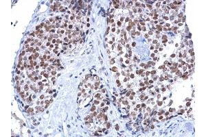 Immunohistochemistry (IHC) image for anti-helicase 2, X-linked (ATRX) (C-Term) antibody (ABIN2855005)