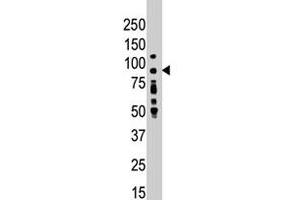 Western blot analysis of PRKCD polyclonal antibody  in placenta lysate . (PKC delta 抗体  (N-Term))