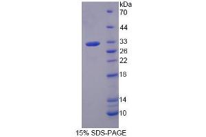 SDS-PAGE analysis of Human GNb3 Protein. (GNB3 蛋白)