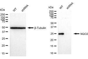 Western blotting analysis using NQO2 antibody (ABIN7799626). (Recombinant NQO2 抗体)