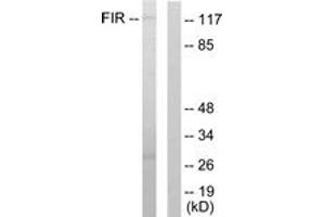 Western blot analysis of extracts from HuvEc cells, using FIR Antibody. (FARP2 抗体  (AA 331-380))