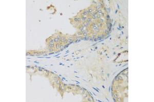Immunohistochemistry of paraffin-embedded human prostate using LLGL2 antibody at dilution of 1:200 (40x lens). (LLGL2 抗体)