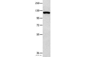 Western blot analysis of 823 cell , using MVP Polyclonal Antibody at dilution of 1:350 (MVP 抗体)