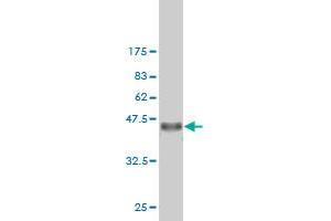 Western Blot detection against Immunogen (36. (Exportin 2 抗体  (AA 872-971))