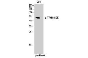 Western Blotting (WB) image for anti-Tryptophan Hydroxylase 1 (TPH1) (pSer58) antibody (ABIN3182629) (Tryptophan Hydroxylase 1 抗体  (pSer58))
