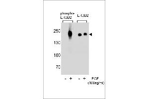 Western blot analysis of extracts from A431 cells,untreated or treated with EGF,100 ng/mL , using phospho-ERBB2-p(L)(left) or ERBB2 Antibody (right) (ErbB2/Her2 抗体  (pTyr1248))