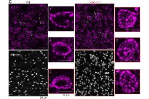 Representative maximum intensity projections from Wild-Type (WT) (black) and NPC1I1061T (red) cortical sagittal sections stained with Hoechst and immunolabeled for KV2.