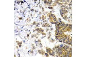 Immunohistochemistry (IHC) image for anti-Neurofilament, Light Polypeptide (NEFL) (AA 400-543) antibody (ABIN3020809)