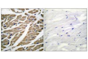 Immunohistochemistry (IHC) image for anti-Sodium Channel (Internal Region), (pan) antibody (ABIN1848776) (Sodium Channel 抗体  (Internal Region, pan))